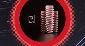 ایмپلنت نوکلئوس اژه بیومدیکال